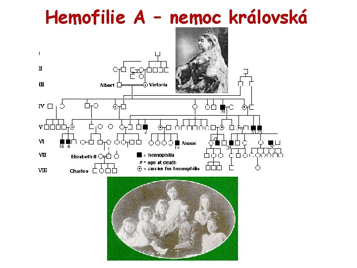 Hemofilie A – nemoc královská 