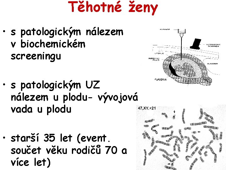 Těhotné ženy • s patologickým nálezem v biochemickém screeningu • s patologickým UZ nálezem