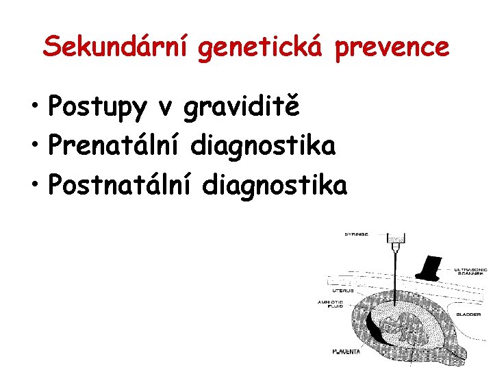 Sekundární genetická prevence • Postupy v graviditě • Prenatální diagnostika • Postnatální diagnostika 