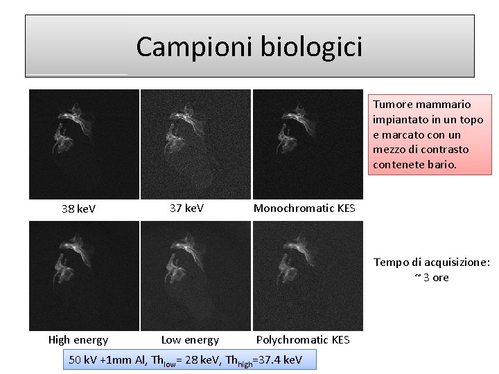 Campioni biologici Tumore mammario impiantato in un topo e marcato con un mezzo di