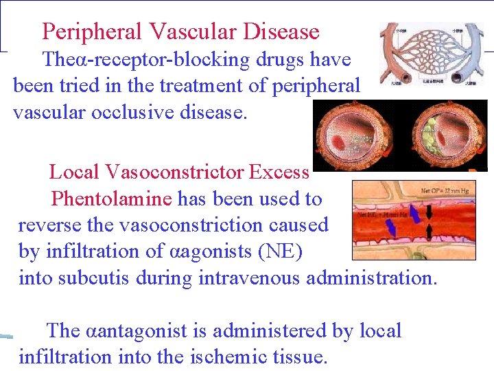 Peripheral Vascular Disease Theα-receptor-blocking drugs have been tried in the treatment of peripheral vascular