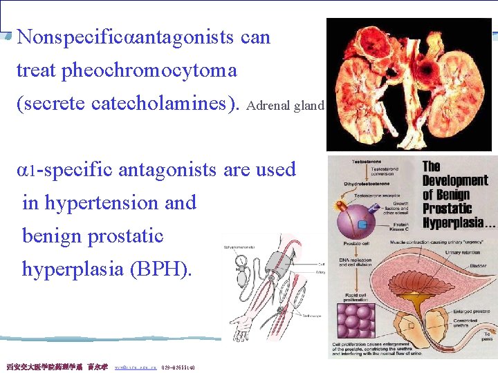 Nonspecificαantagonists can treat pheochromocytoma (secrete catecholamines). Adrenal gland α 1 -specific antagonists are used