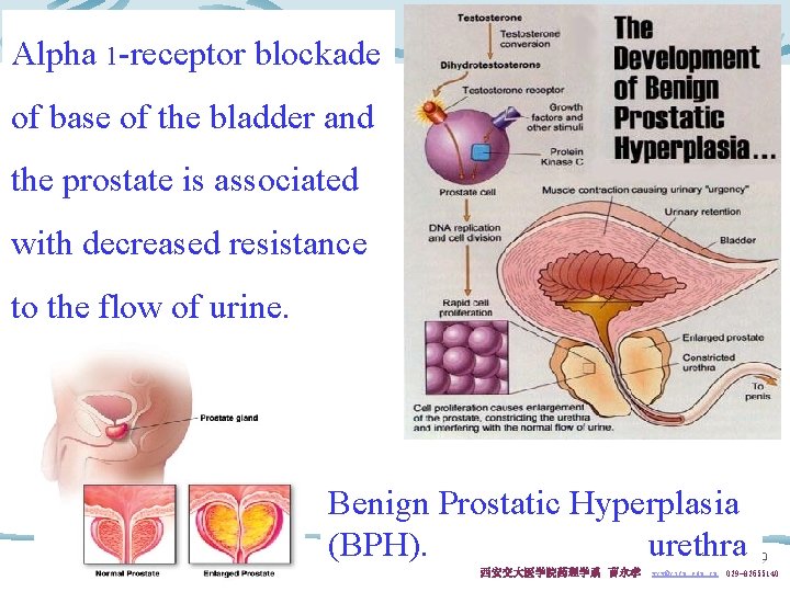 Alpha 1 -receptor blockade of base of the bladder and the prostate is associated