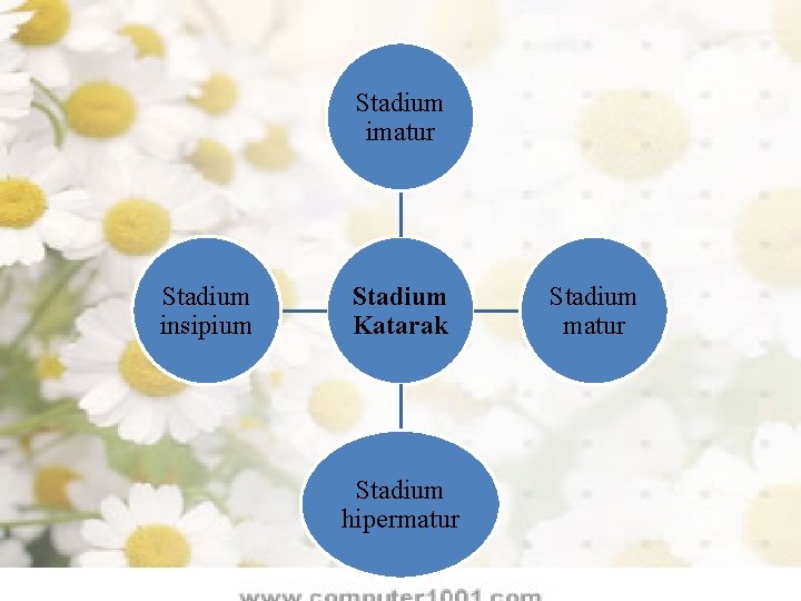 Stadium imatur Stadium insipium Stadium Katarak Stadium hipermatur Stadium matur 