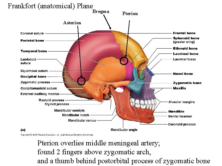 Frankfort (anatomical) Plane Bregma Pterion Asterion Pterion overlies middle meningeal artery; found 2 fingers