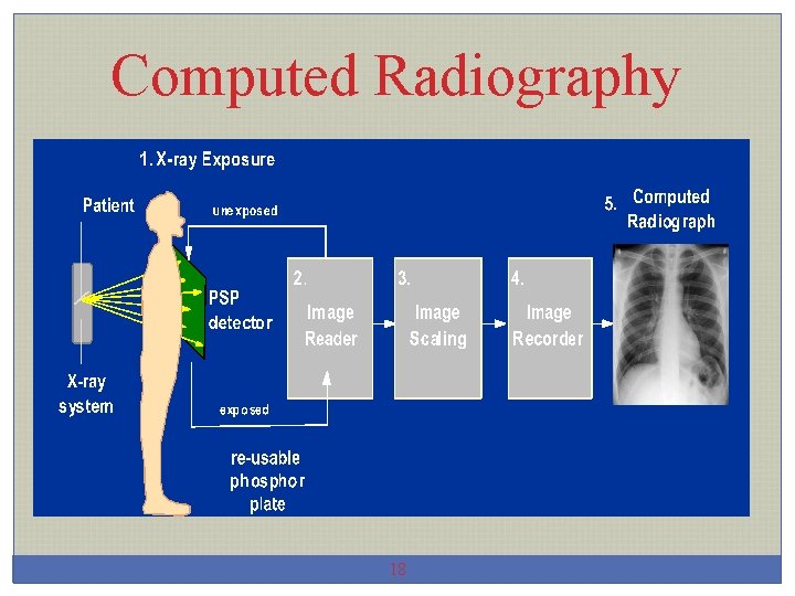 Computed Radiography 18 