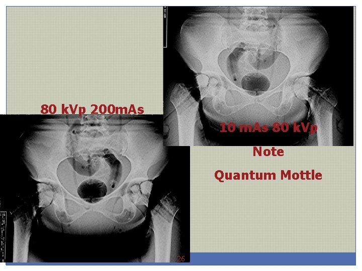 80 k. Vp 200 m. As 10 m. As 80 k. Vp Note Quantum