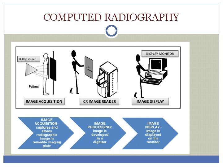 COMPUTED RADIOGRAPHY 