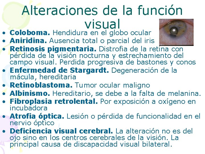 Alteraciones de la función visual Coloboma. Hendidura en el globo ocular • • Aniridina.