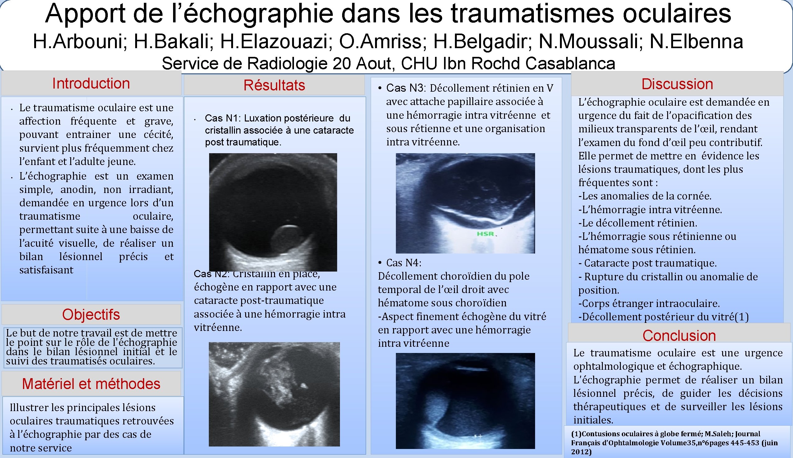 Apport de l’échographie dans les traumatismes oculaires H. Arbouni; H. Bakali; H. Elazouazi; O.