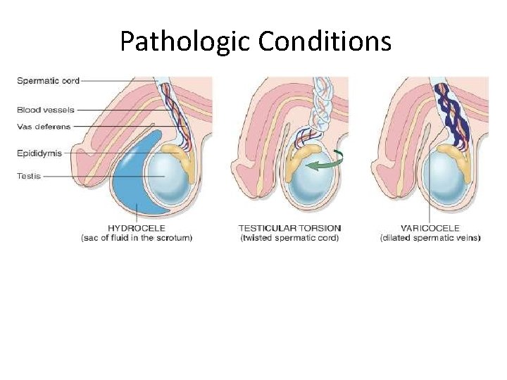 Pathologic Conditions 