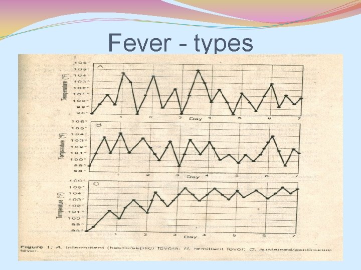 Fever - types 