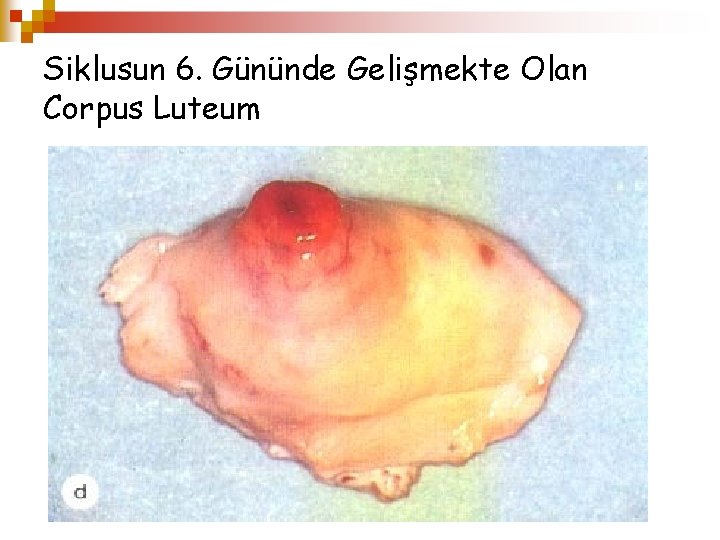 Siklusun 6. Gününde Gelişmekte Olan Corpus Luteum 