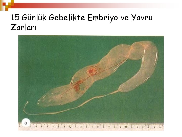 15 Günlük Gebelikte Embriyo ve Yavru Zarları 