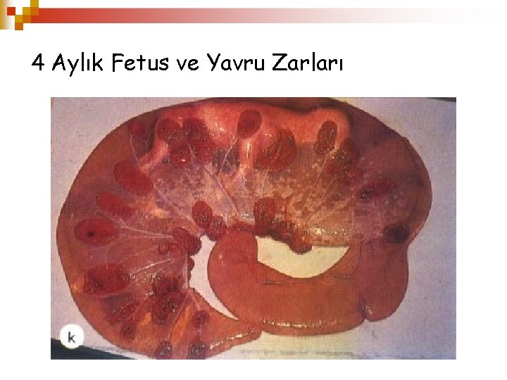 4 Aylık Fetus ve Yavru Zarları 