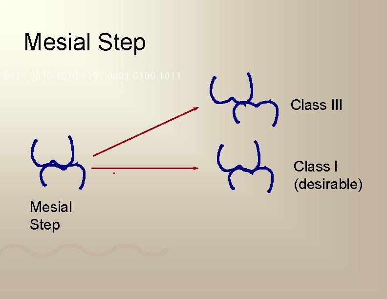 Mesial Step Class III Class I (desirable) Mesial Step 