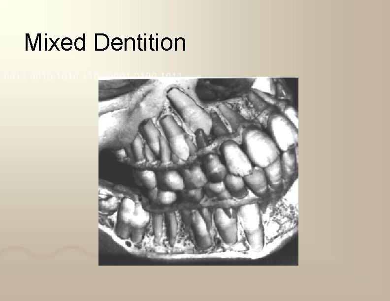 Mixed Dentition 