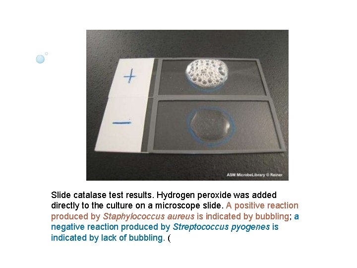 Slide catalase test results. Hydrogen peroxide was added directly to the culture on a