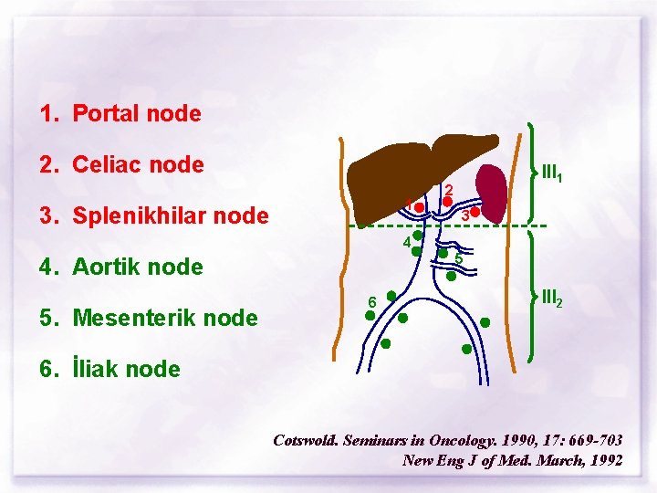 1. Portal node 2. Celiac node 1 3. Splenikhilar node III 1 2 3