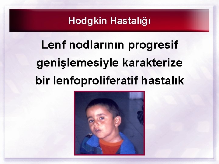 Hodgkin Hastalığı Lenf nodlarının progresif genişlemesiyle karakterize bir lenfoproliferatif hastalık 