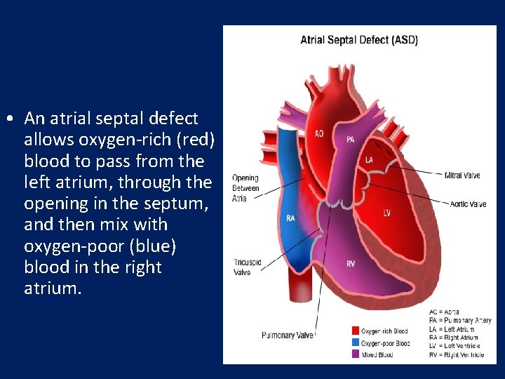  • An atrial septal defect allows oxygen-rich (red) blood to pass from the