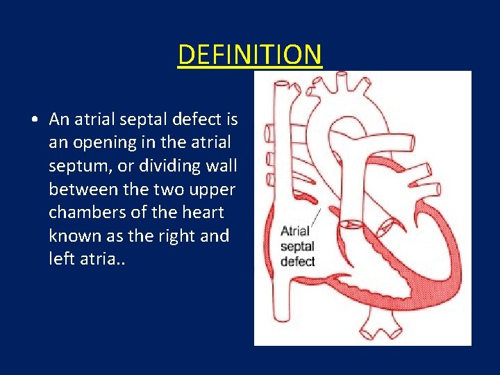 DEFINITION • An atrial septal defect is an opening in the atrial septum, or