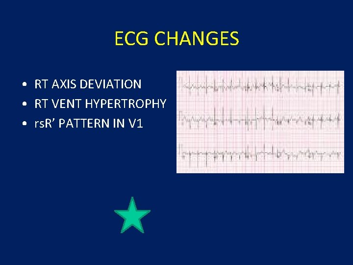 ECG CHANGES • RT AXIS DEVIATION • RT VENT HYPERTROPHY • rs. R’ PATTERN