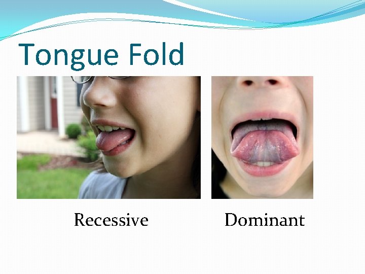 Tongue Fold Recessive Dominant 