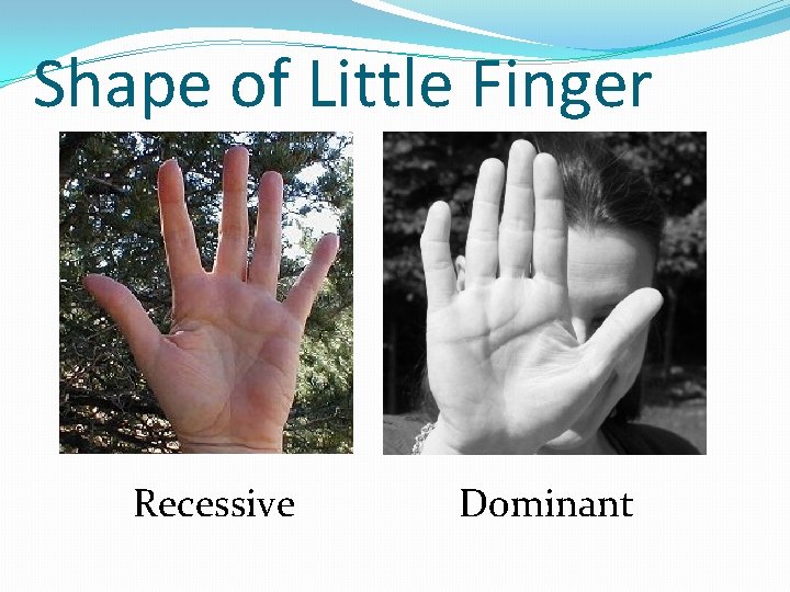 Shape of Little Finger Recessive Dominant 