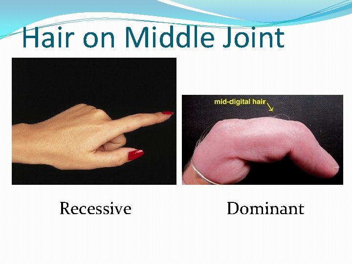 Hair on Middle Joint Recessive Dominant 