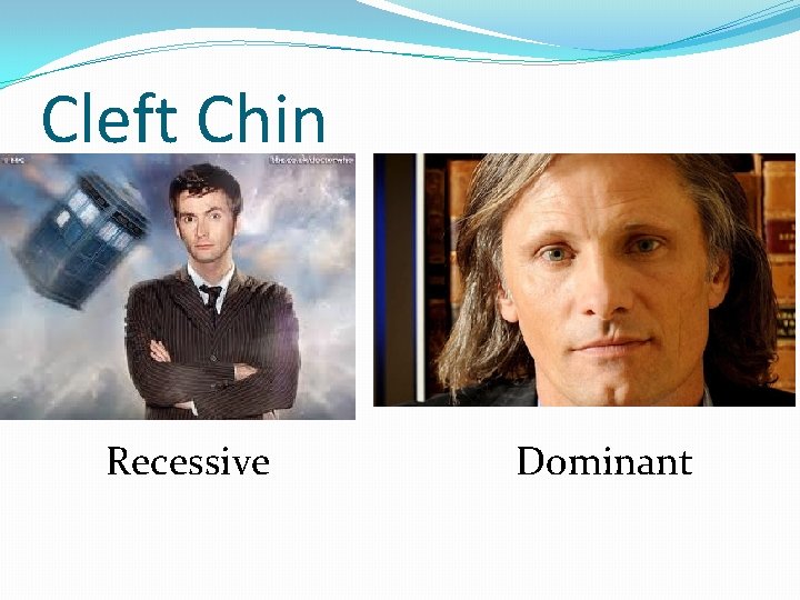 Cleft Chin Recessive Dominant 