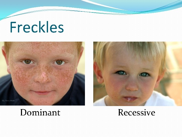 Freckles Dominant Recessive 