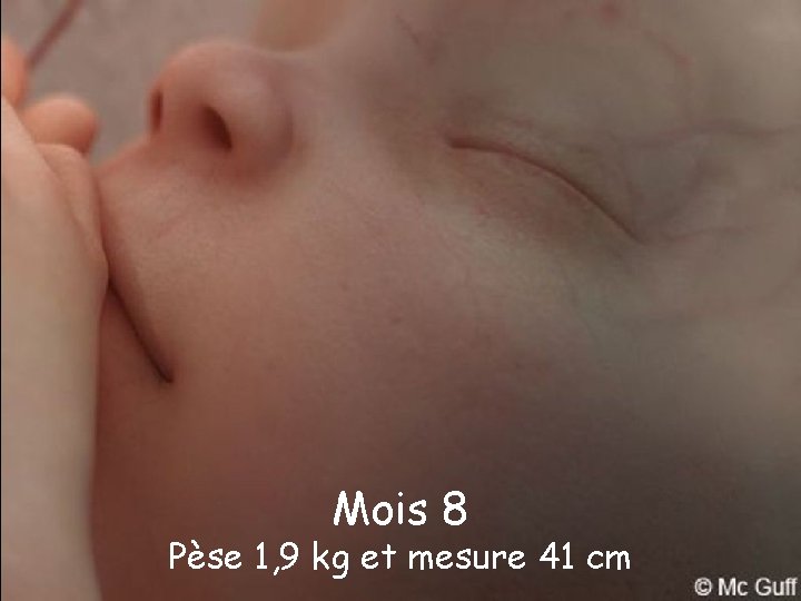 Mois 8 Pèse 1, 9 kg et mesure 41 cm 