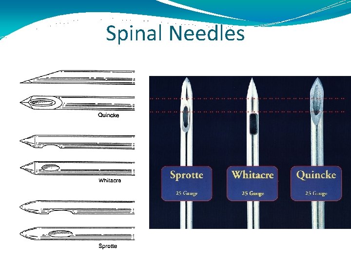 Spinal Needles 