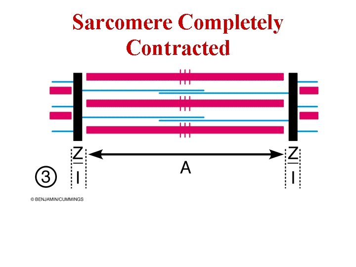 Sarcomere Completely Contracted 