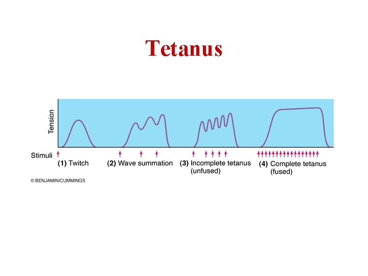 Tetanus 