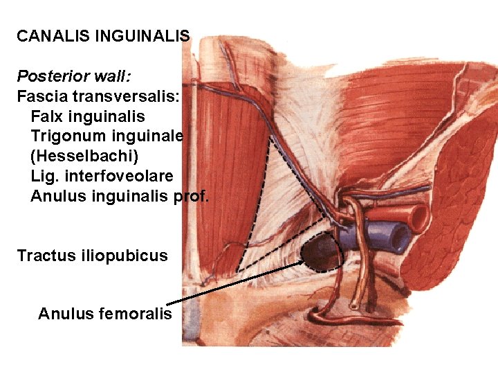 CANALIS INGUINALIS Posterior wall: Fascia transversalis: Falx inguinalis Trigonum inguinale (Hesselbachi) Lig. interfoveolare Anulus CANALIS INGUINALIS Posterior wall: Fascia transversalis: Falx inguinalis Trigonum inguinale (Hesselbachi) Lig. interfoveolare Anulus