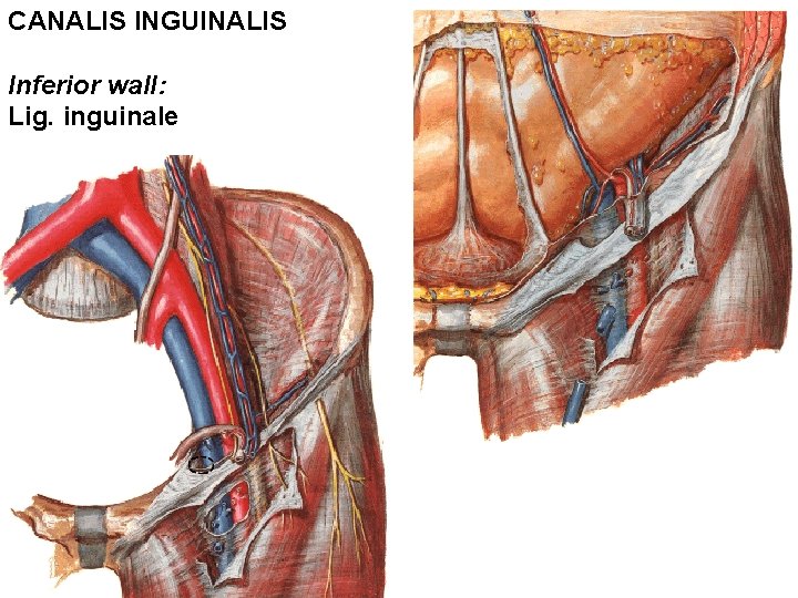 CANALIS INGUINALIS Inferior wall: Lig. inguinale CANALIS INGUINALIS Inferior wall: Lig. inguinale