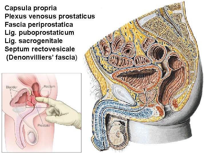 Capsula propria Plexus venosus prostaticus Fascia periprostatica Lig. puboprostaticum Lig. sacrogenitale Septum rectovesicale (Denonvilliersʼ Capsula propria Plexus venosus prostaticus Fascia periprostatica Lig. puboprostaticum Lig. sacrogenitale Septum rectovesicale (Denonvilliersʼ