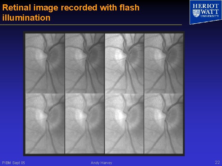 Retinal image recorded with flash illumination PIBM Sept 05 Andy Harvey 22 