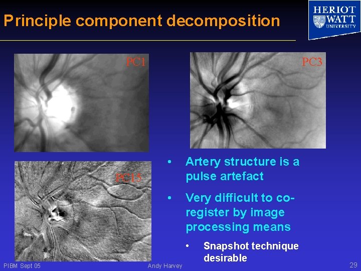 Principle component decomposition PC 1 PC 3 • Artery structure is a pulse artefact