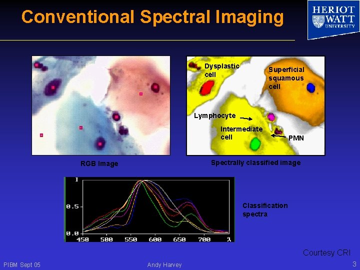 Conventional Spectral Imaging Dysplastic cell Superficial squamous cell Lymphocyte Intermediate cell PMN Spectrally classified