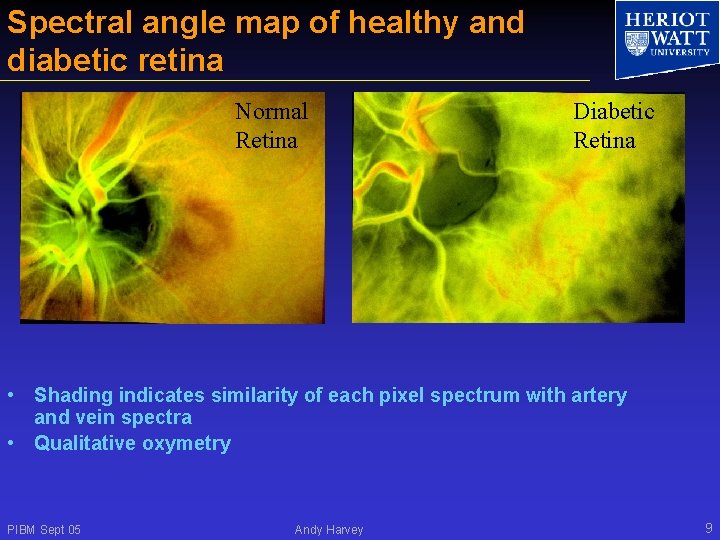 Spectral angle map of healthy and diabetic retina Normal Retina Diabetic Retina • Shading