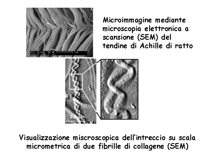 Microimmagine mediante microscopia elettronica a scansione (SEM) del tendine di Achille di ratto Visualizzazione