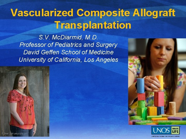 Vascularized Composite Allograft Transplantation S. V. Mc. Diarmid, M. D. Professor of Pediatrics and