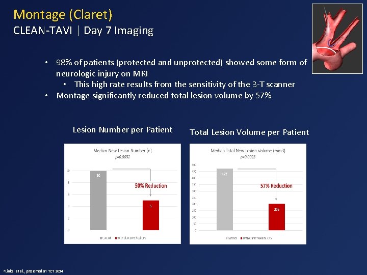 Montage (Claret) CLEAN-TAVI | Day 7 Imaging • 98% of patients (protected and unprotected)