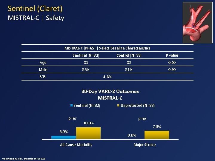 Sentinel (Claret) MISTRAL-C | Safety MISTRAL-C (N=65) | Select Baseline Characteristics Sentinel (N=32) Control