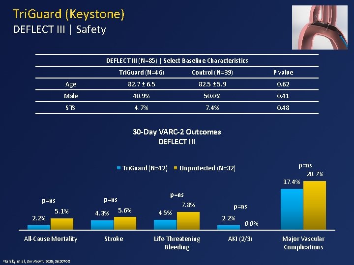 Tri. Guard (Keystone) DEFLECT III | Safety DEFLECT III (N=85) | Select Baseline Characteristics