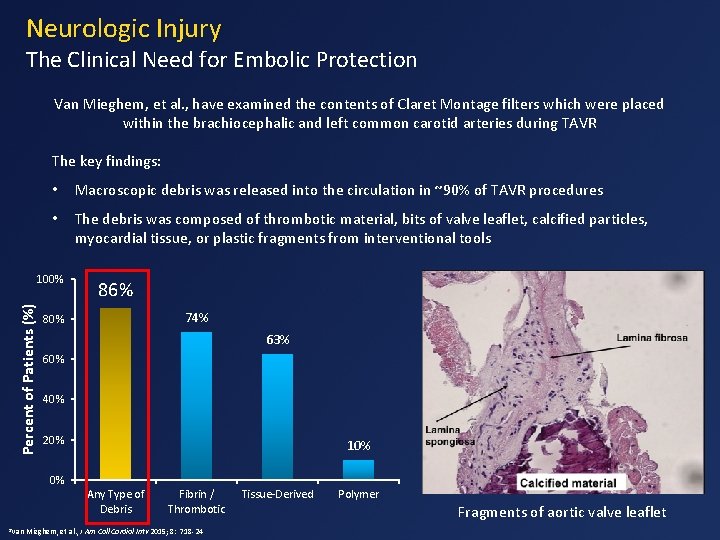 Neurologic Injury The Clinical Need for Embolic Protection Van Mieghem, et al. , have