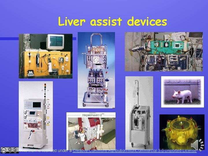 Liver assist devices This work is licensed under a Creative Commons Attribution-Non. Commercial 3.